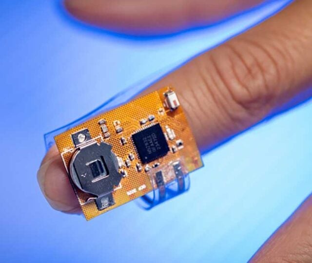 Researchers have developed a wearable sensor that continuously monitors Parkinson's disease medication levels through a patient's sweat.